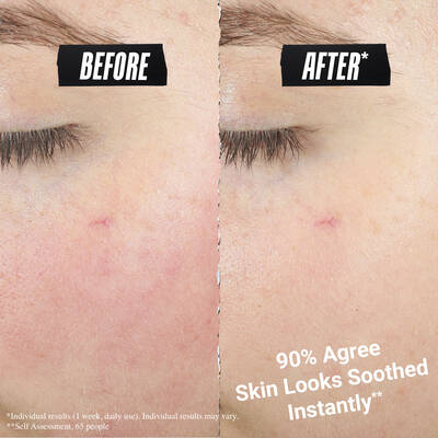Side-by-side comparison labeled “before” and “after*,” showing reduced redness on the skin. Text reads “90% Agree skin looks soothed instantly**  Small print disclaimer appears at the bottom.