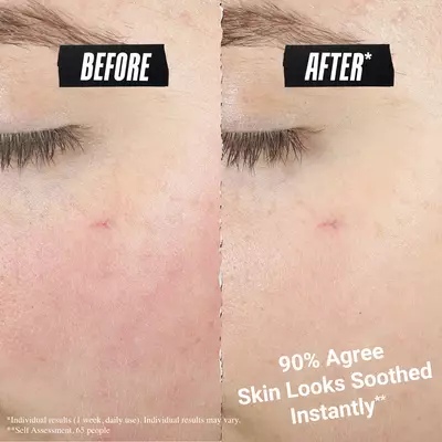 Side-by-side comparison labeled “before” and “after*,” showing reduced redness on the skin. Text reads “90% Agree skin looks soothed instantly**  Small print disclaimer appears at the bottom.